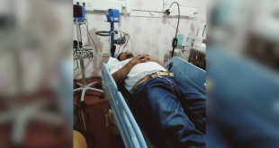 Niat Usir Kobra, Warga Pademawu Jadi Korban Semburan Bisa